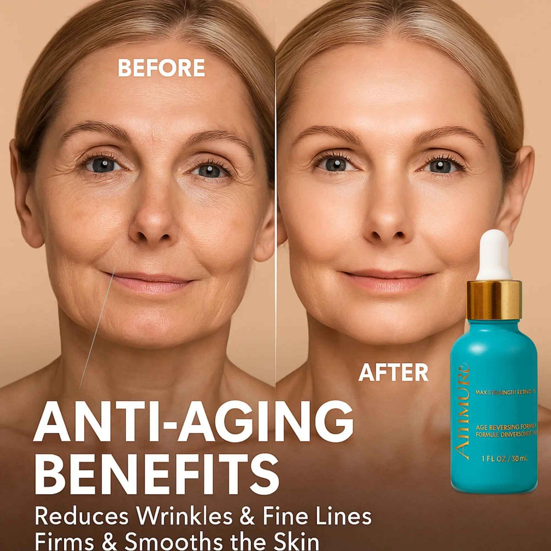 Ammuri Skincare 5% Retinol MAX Powerful Anti-Aging Serum for Youthful Skin