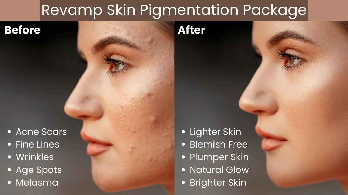 Ammuri Pigmentation Skincare Gift Set - Brightening Dark Spot Treatment Bundle