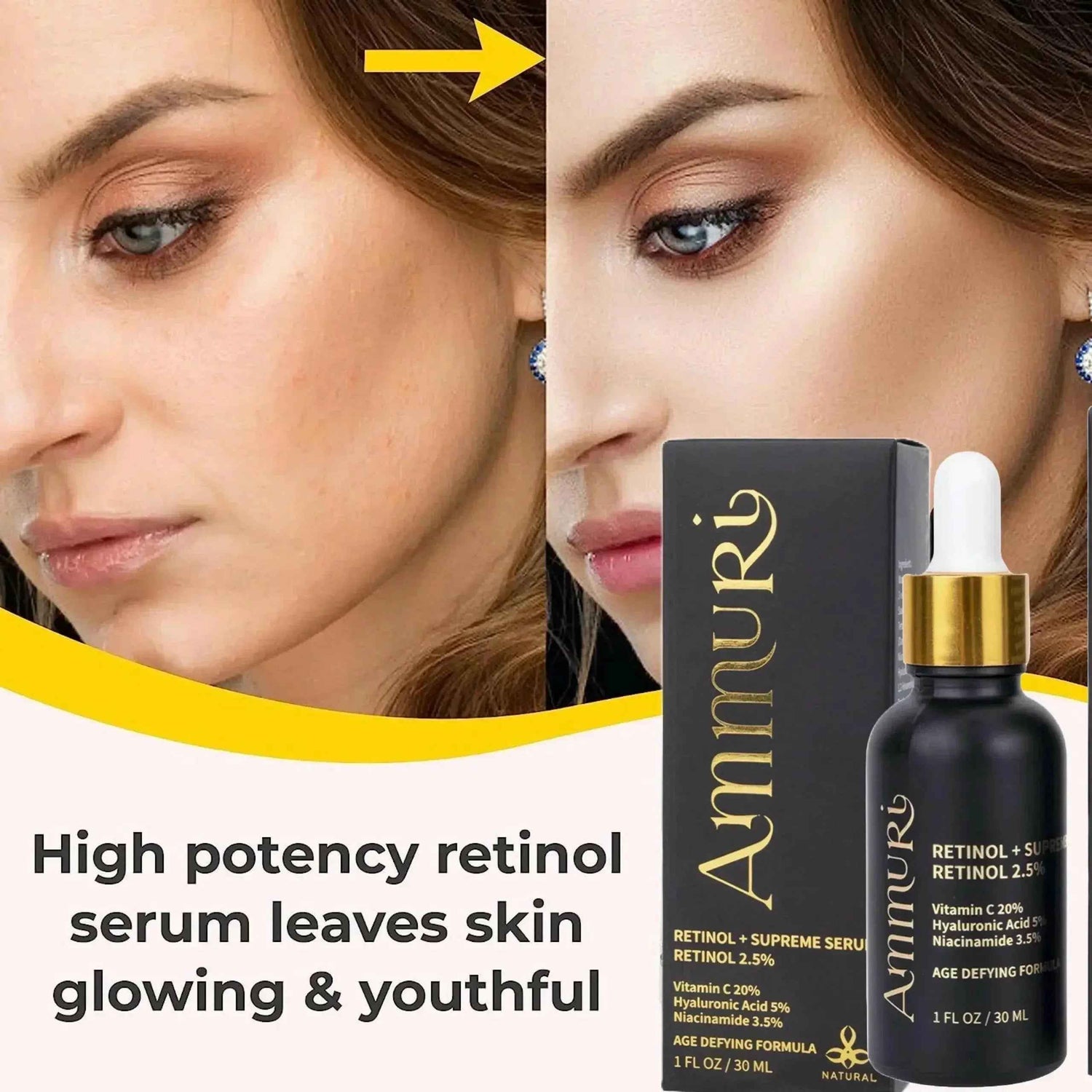 Ammuri Retinol Supreme 2.5% Serum – Anti-Aging Treatment - Age-Defying Formula