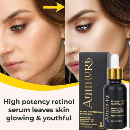 Ammuri Retinol Supreme 2.5% Serum – Anti-Aging Treatment - Age-Defying Formula
