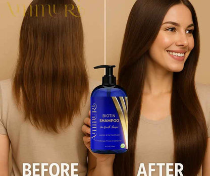 Ammuri Biotin DHT Blocker Shampoo - Sulfate-Free Hair Loss Treatment 473ml