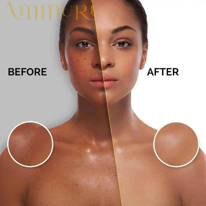 Ammuri Extreme Lightening Serum