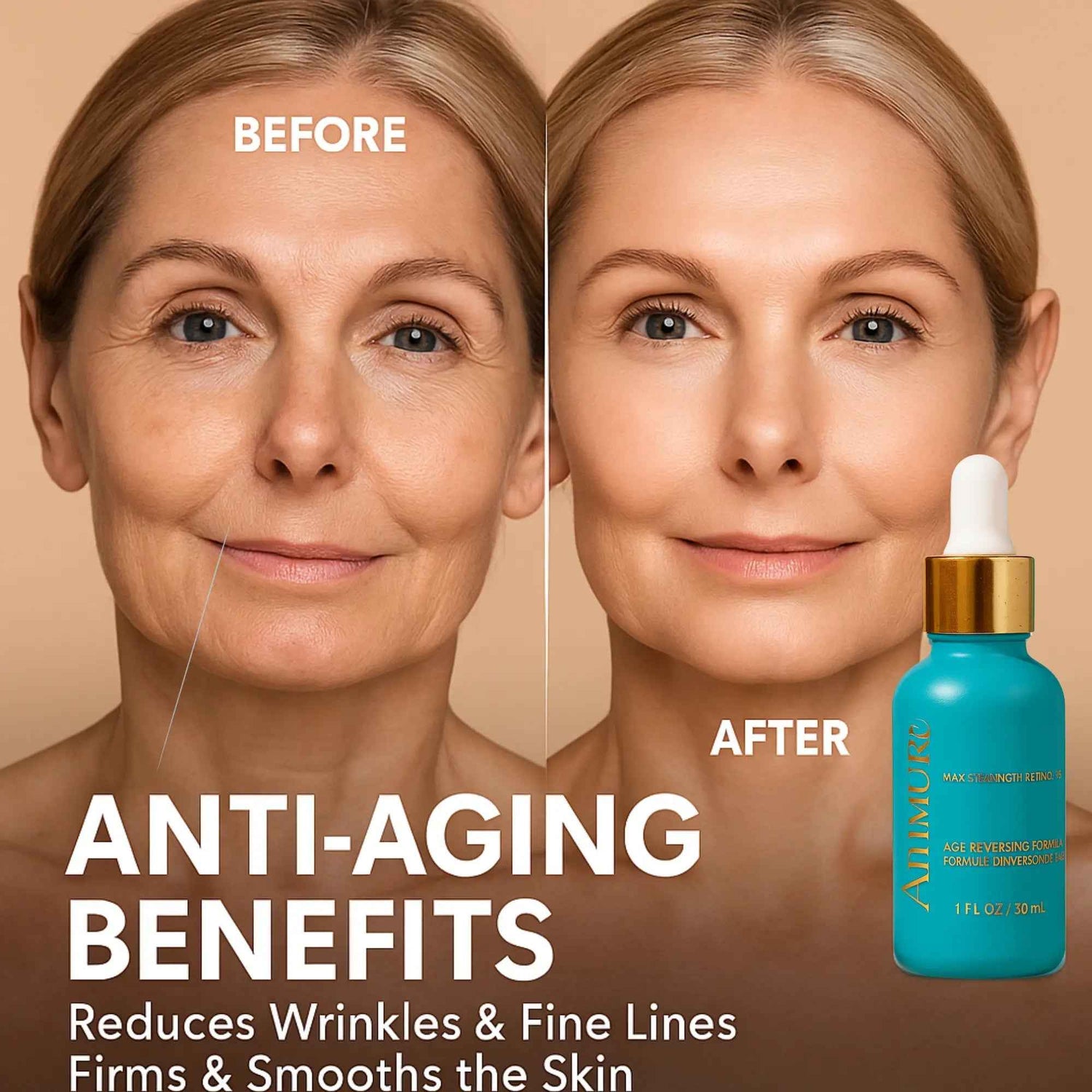 Ammuri Skincare 5% Retinol MAX Powerful Anti-Aging Serum for Youthful Skin