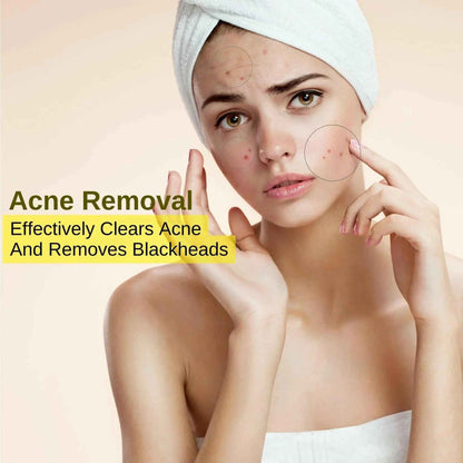 Ammuri 24K Gold Peel-Off Face Mask – Deep Cleansing &amp; Brightening Pore Minimiser (60ml)