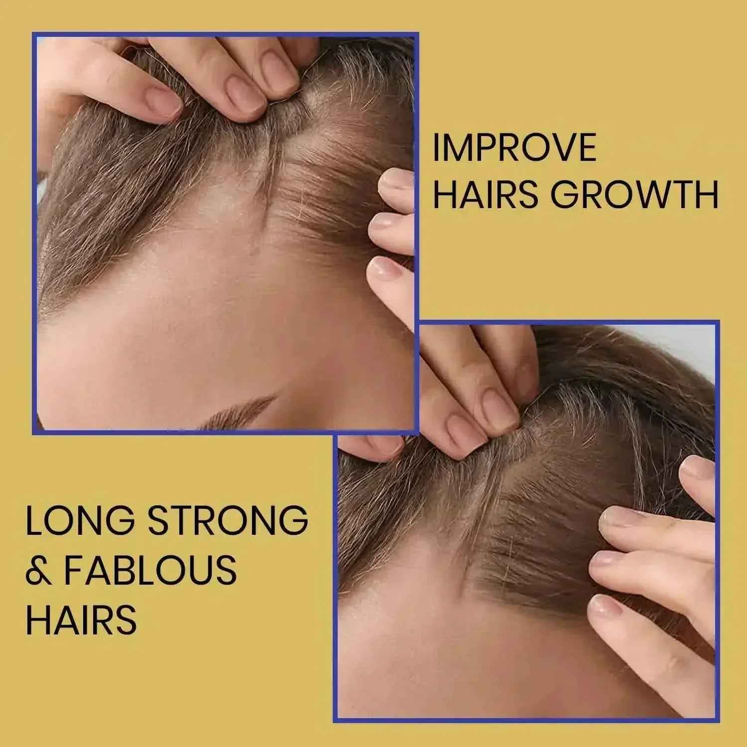 Ammuri Biotin Haircare Set – Anti-Hair Loss Shampoo &amp; Strengthening Hair Serum for Men &amp; Women