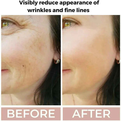 Ammuri Skincare Anti Aging Face Serum - High Volume Retinol 3.5%