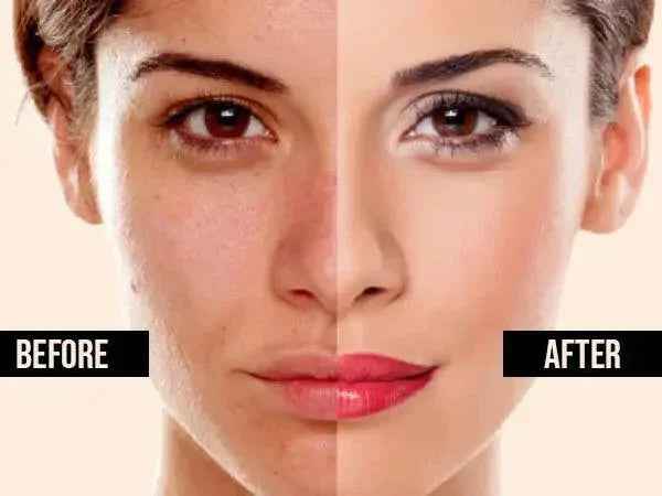 Ammuri Brightening Moisturiser Cream – For Face, Body &amp; Sensitive Areas (50g)