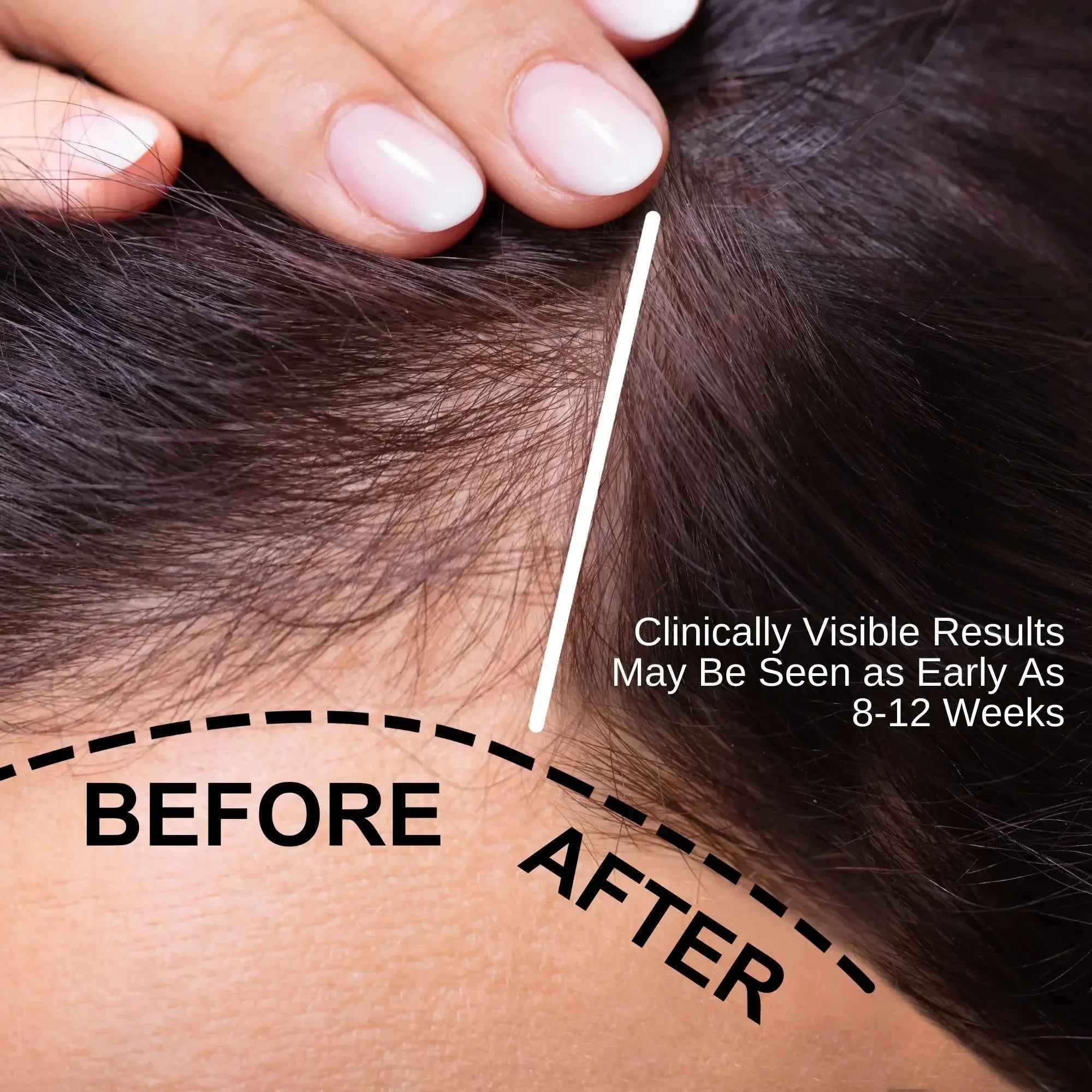 Ammuri Natural Hair Oil – Nourishing Scalp &amp; Hair Care for Thicker-Looking Hair (50ml)