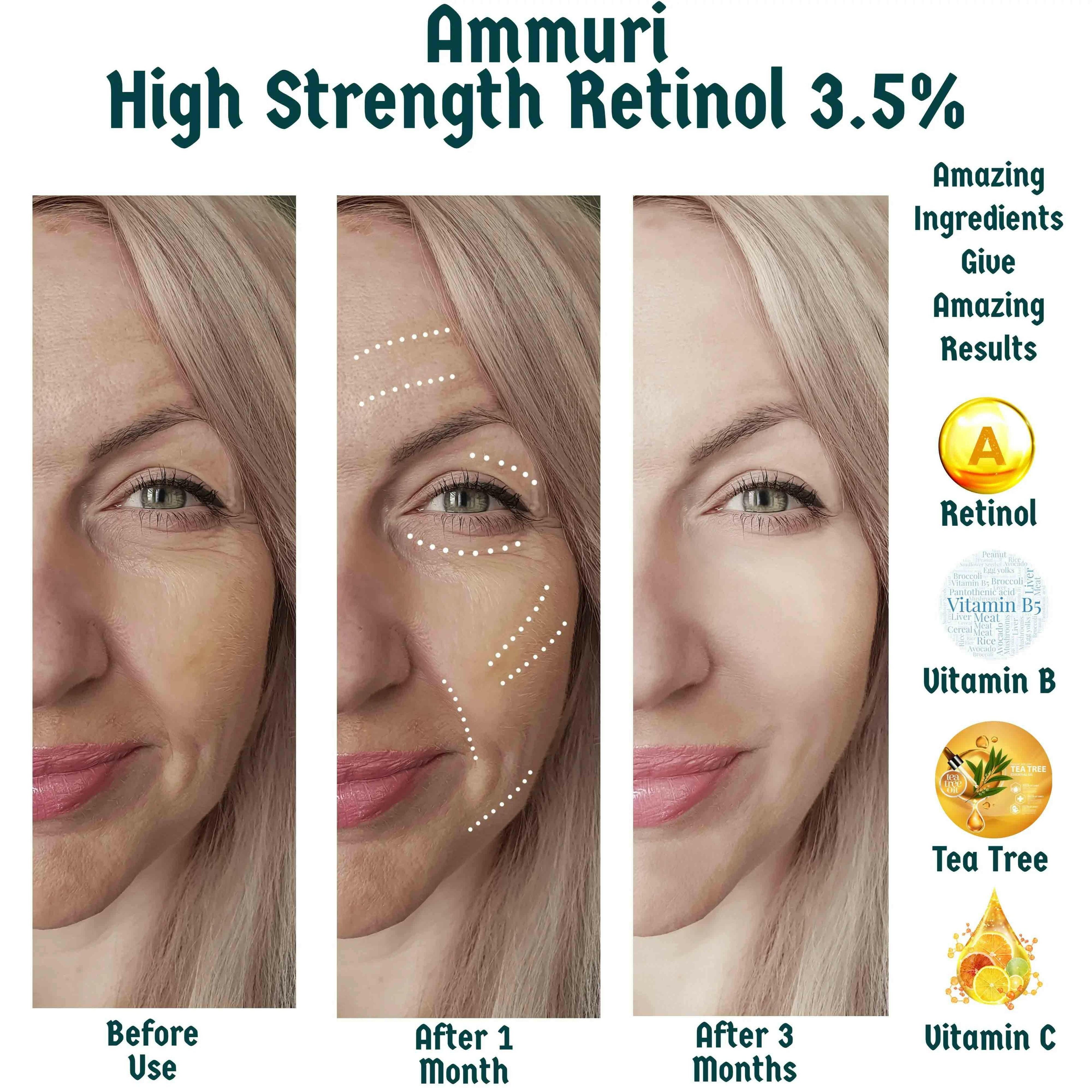 Ammuri Skincare High Strength Retinol Serum 3.5%