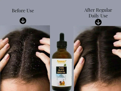 Pure Organic Black Seed Oil | Cold-Pressed Nigella Sativa for Skin, Hair &amp; Wellness – Ammuri Beauty