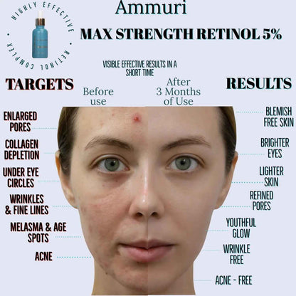 Ammuri Retinol 5% Serum for Anti-Ageing Skin Revitalization
