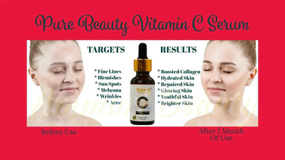 Ammuri Vitamin C Serum for Glowing Skin - Anti-Ageing