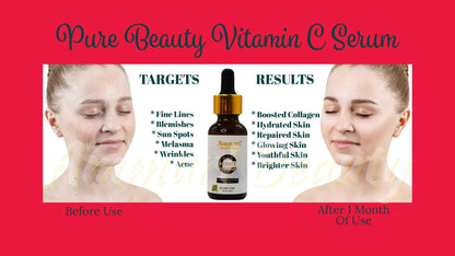 Ammuri Vitamin C Serum for Anti-Ageing &amp; Radiance