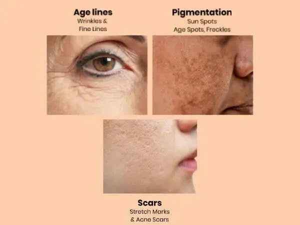 Ammuri Retinol Apple Stem Cell Age Reverse Cream