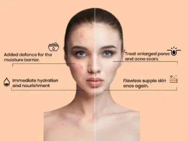 Ammuri Retinol Apple Stem Cell Age Reverse Cream