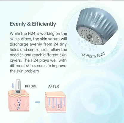 Ammuri Adjustable Derma Roller – 6-in-1 Microneedle Skin Tool for Face, Hair &amp; Body